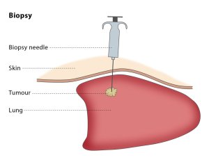 biopsy guided meaning procedure cirse ir medfriendly tissue vision life words together perform why
